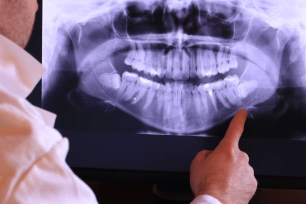 Best Emergency Dental Care for Broken or Chipped Teeth in Moosup, CT